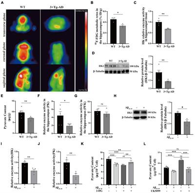 Suppression of hnRNP A1 binding to HK1 RNA leads to glycolytic dysfunction in Alzheimer’s disease models